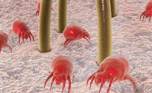 脸上的螨虫能彻底消灭吗,螨虫越挤毛孔越大越堆积螨虫吗