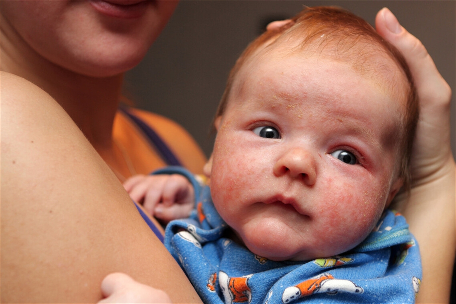 宝宝的皮肤一到秋天就干燥发红,宝宝秋季脸干燥发红怎么办