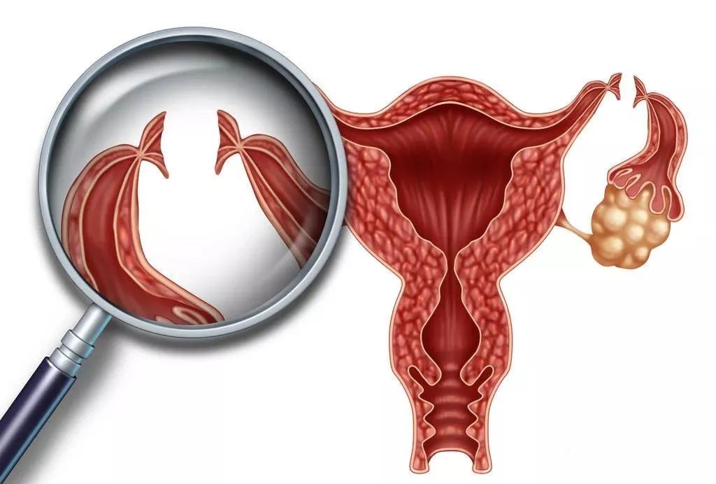 出现这五种信号要警惕卵巢癌变,出现以下症状警惕癌症