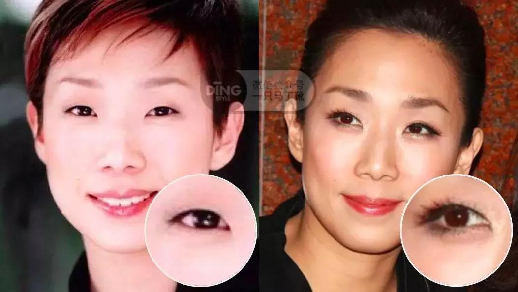 中庭短显年轻还是显老,中庭长怎么避免显老