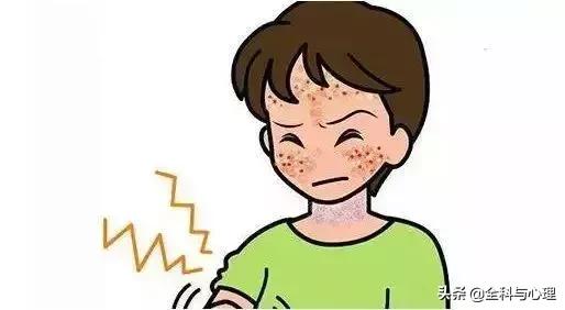 临床最常见的药物过敏反应是什么,药物过敏的10种症状图片