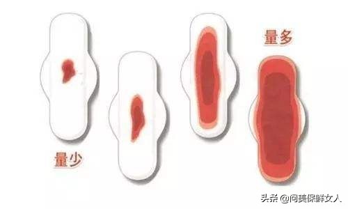 祛斑真实案例内调,祛斑案例说说