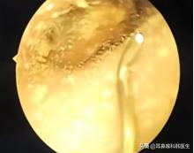 为啥来院就做内镜检查?医生怕是在骗我钱吧