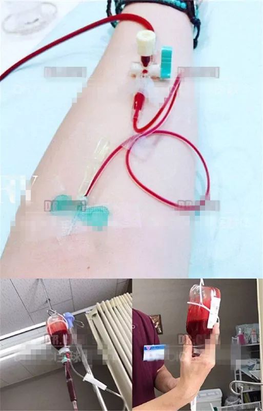 跟着明星吃这个，23岁女孩付出惨痛代价！这些网红减肥美容方法太可怕……