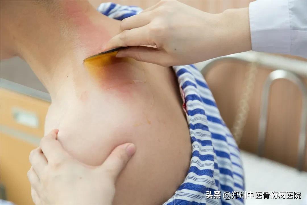 郑州市中医骨伤病医院,郑州中医骨伤医院最新消息