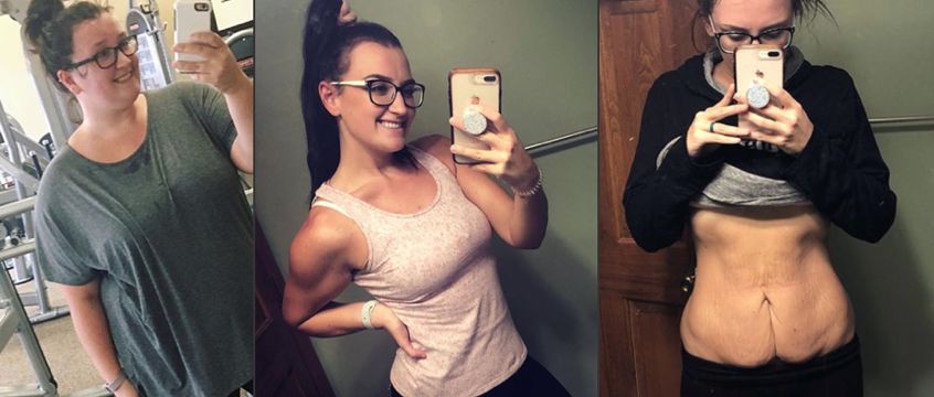 减重太快皮肤松弛能自我恢复吗,减重减得太快身体会出现哪些问题