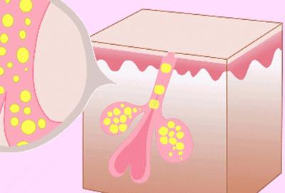 不做油腻少女,不做油腻中年少女