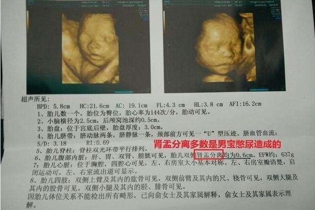 想要小棉袄,想要小棉袄的原因