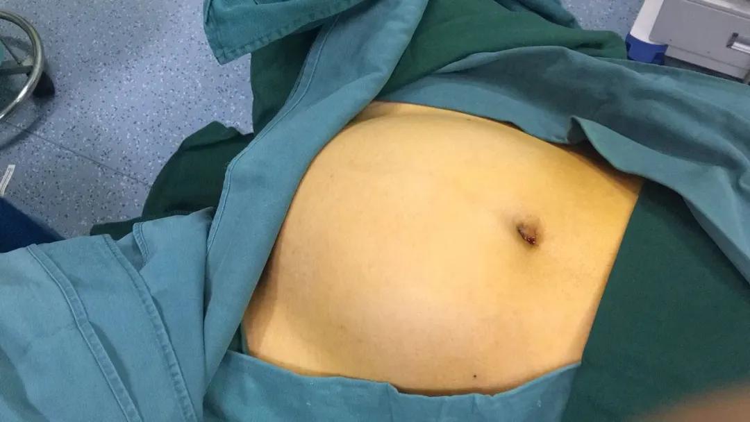 「人医风采」铿锵玫瑰显身手——记市一院妇科主任魏珂