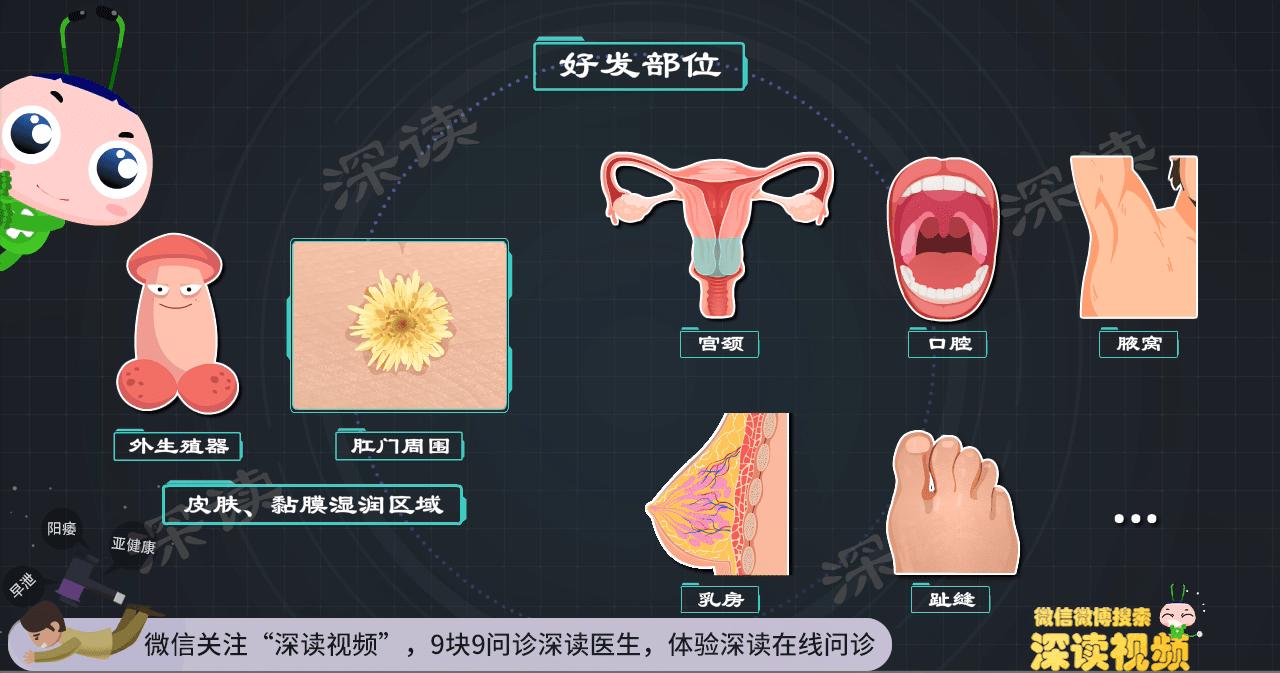 男生得了尖锐性湿疣一定得了hpv吗,小伙口腔长尖锐病毒湿疣
