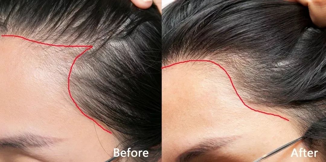 双十一适合买什么,双十一来了是买还是不买