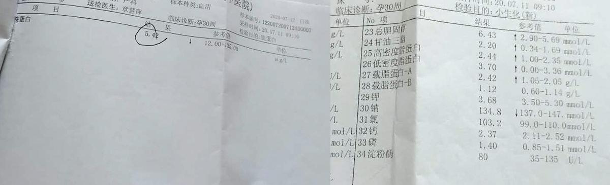 孕妇孕晚期铁蛋白低怎么补上去,孕晚期铁蛋白偏低是什么意思啊