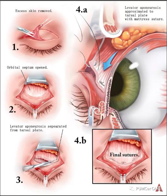 灵魂画手！协和医学生手绘器官解剖图，极具艺术美感，走红网络！