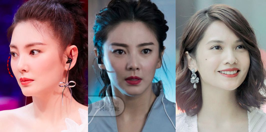 张雨绮杨丞琳对比,张雨绮眼型分析