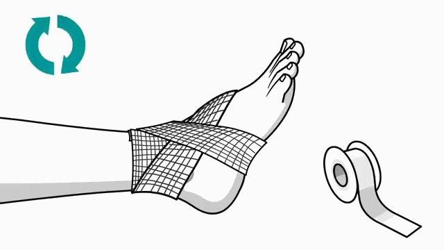 崴脚了用什么加压包扎,打篮球崴脚加压包扎