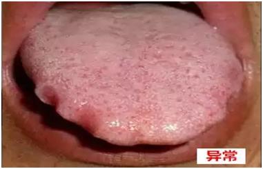 看舌头怎么知道健康不健康,如何通过舌象自测疾病的方法