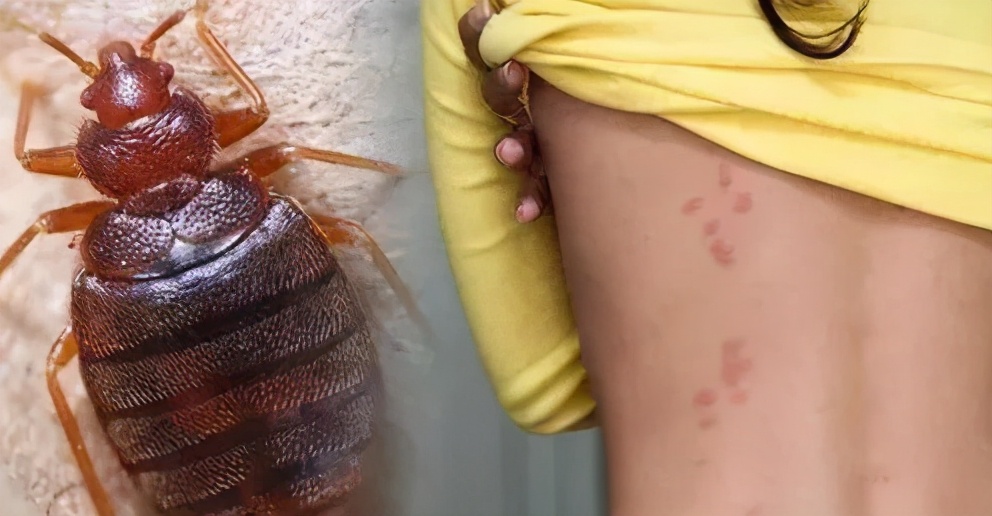 家里臭虫太多了怎么消灭它们,宿舍床上臭虫怎么消灭最彻底