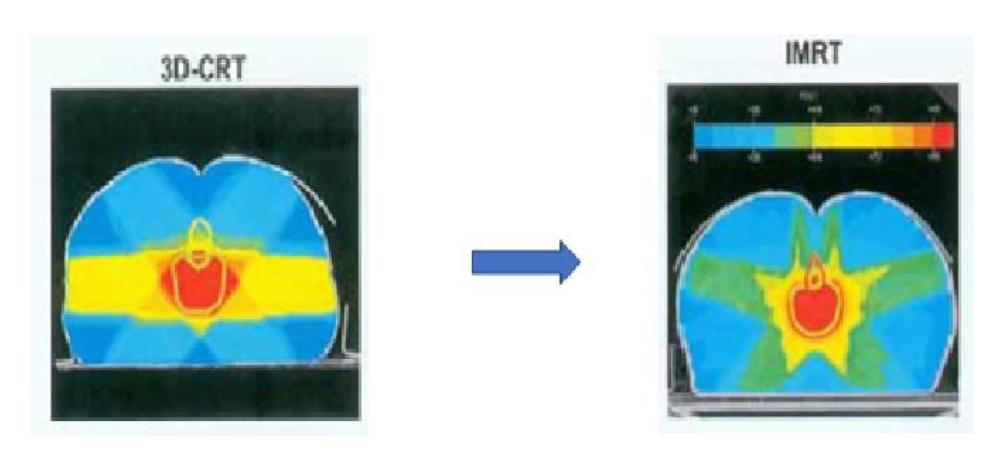 医用加速器研发岗位有前途吗,医用加速器有几种