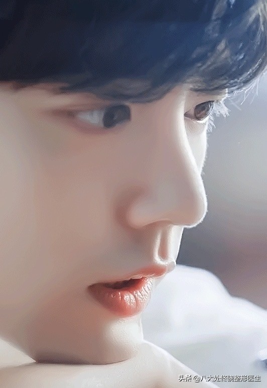 面部一枝花全靠鼻子当家,鼻子一针玻尿酸效果图