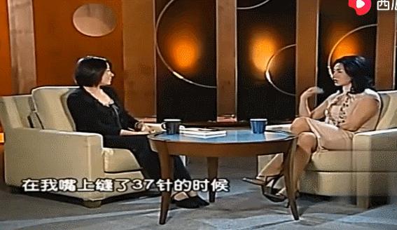 37针不打麻药，翻开皮肉剔除毛囊，做变性手术的金星曾有多痛苦？