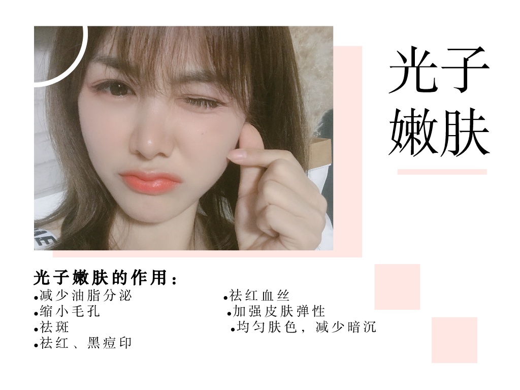 光子嫩肤540,480nm光子嫩肤