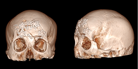 安徽一男子骑车不减速被轿车撞飞,男子开车被陨石砸中