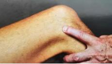 髂胫束摩擦综合征（膝外侧疼痛）跑步杀手，自我预防、康复的方法