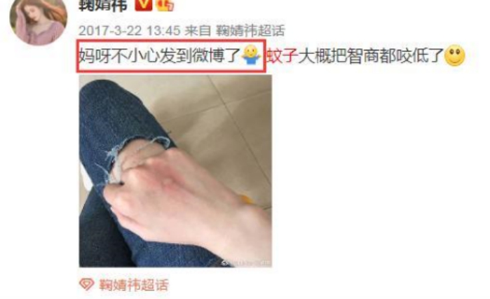 鞠婧祎1人用5替身引爆热搜,鞠婧祎被蚊子咬现代剧