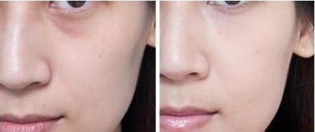 郭鸿财面膜加工视频,郭鸿财抗衰老护肤品