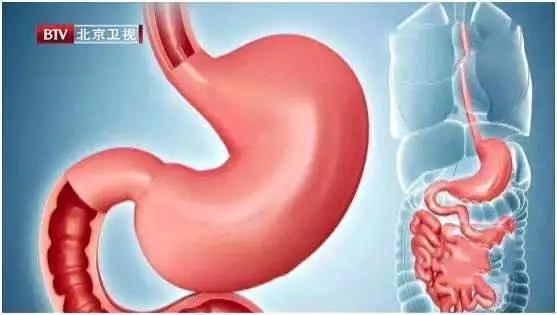 不饿到嘴馋忍不住一直吃东西咋办,明明不饿就想吃东西而且停不下来