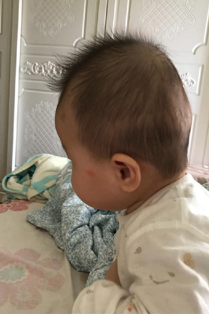 宝宝睡偏头了怎么办还能纠正吗,大月龄宝宝偏头睡觉如何矫正