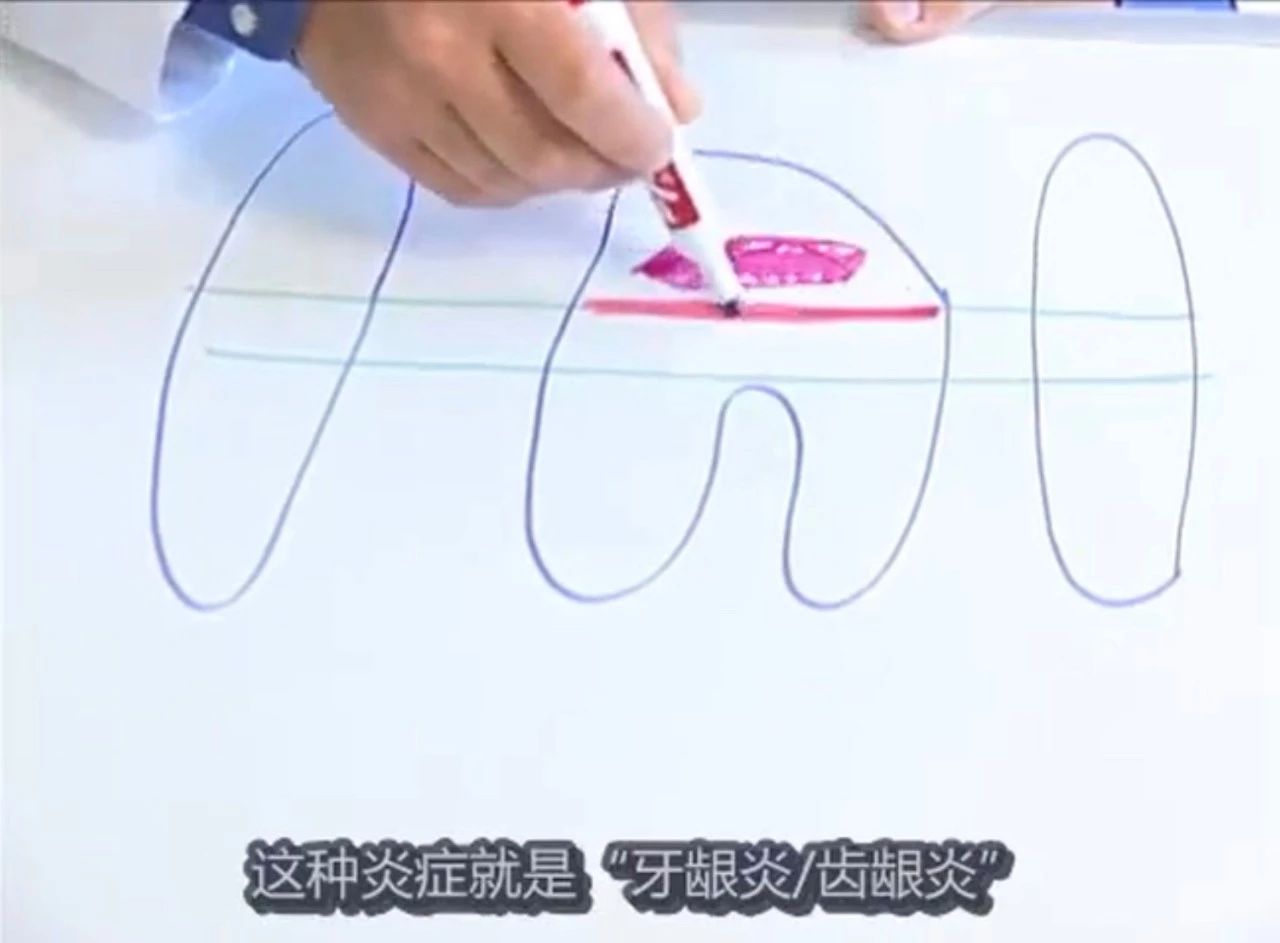 猫有牙周炎该怎么治疗,猫有牙龈炎怎么治疗