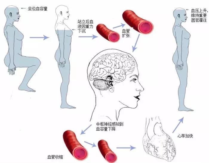 高血压可别不当回事,体位性高血压应如何服药