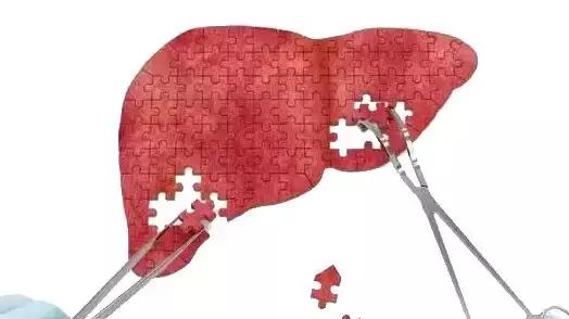 方药中老先生:诊断肝癌后,存活13年未复发,中医如何有效治疗肝癌