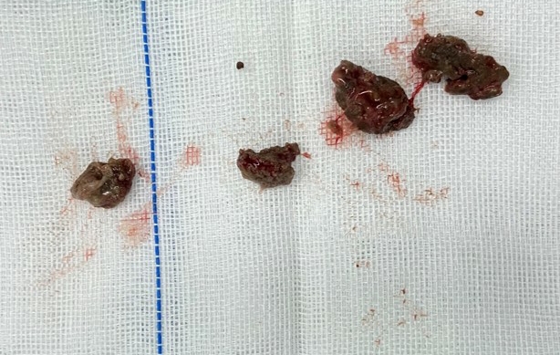 孩子脸歪可以矫正吗,孩子脸有点歪怎么回事