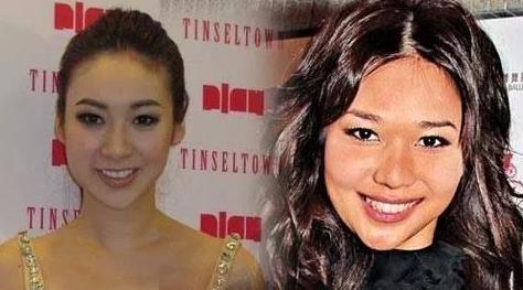 抗衰不再是简单的面部抗衰,风靡全球面部抗衰的最好方法