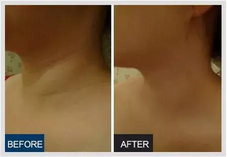 李佳琦推荐的这款日本蜜梨面霜，几分钟卖2万瓶？