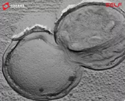 塑料降解微生物的发展,塑料可以被微生物降解吗