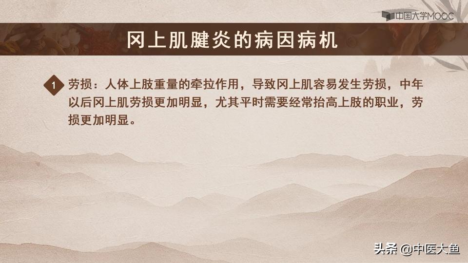 冈上肌腱炎的体征,冈上肌肌腱炎的症状及治疗