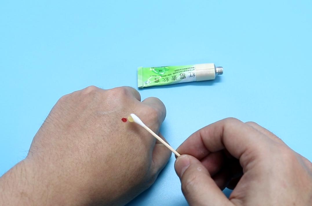 红霉素软膏如何合理运用,红霉素软膏的妙用你知道多少