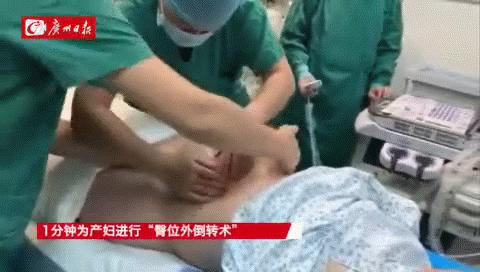 神奇1分钟!胎位不正医生隔着肚皮手动“大挪移”,剖转顺