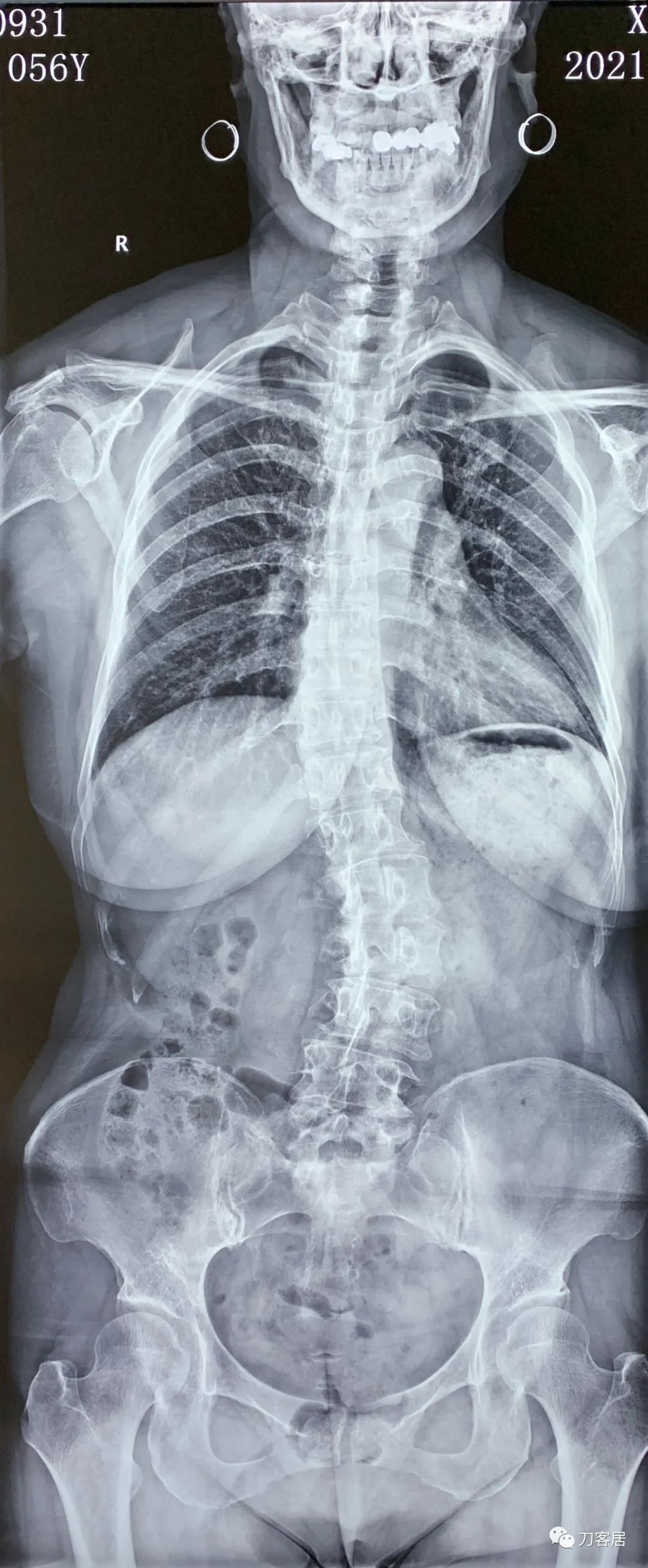 我的门诊病历,我的门诊