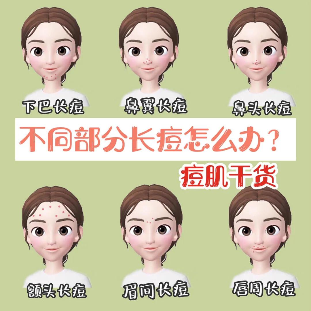 油痘肌大面积痘痘怎么消除,痘痘肌怎么才能不反复长痘