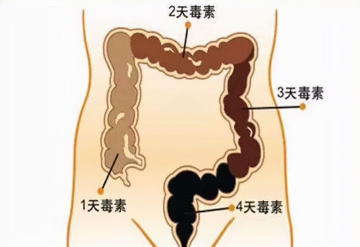 人体内真有6公斤宿便吗？怎么才能排出那些“赖着不走”的宿便？