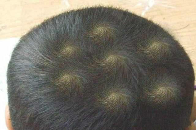 宝宝头旋不同数量和位置，暗示不同人生，很多人想错了