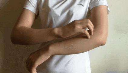 痒带有刺痛感的红斑是什么,红斑瘙痒是什么病