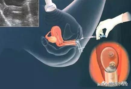 徐静蕾谈与黄立行的感情,徐静蕾文艺告白黄立行如何