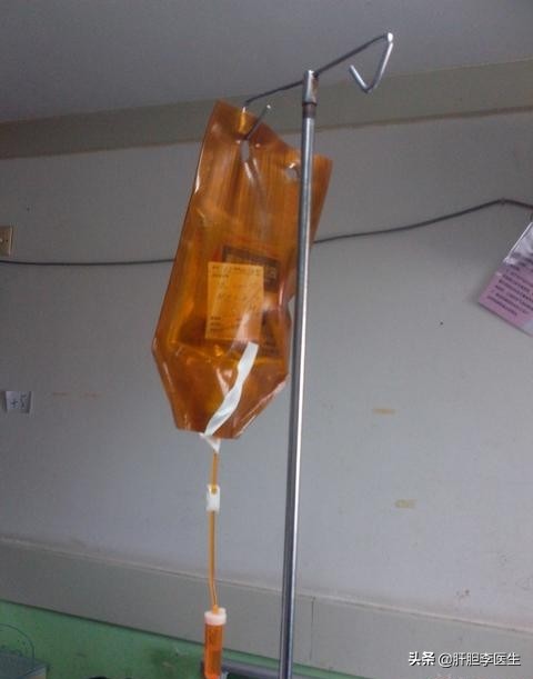 结肠癌晚期怎么才能彻底治愈,结肠癌晚期转移肝可以治愈吗