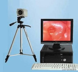 孕期tct有必要做吗,孕期查出tct异常治疗还是忍着