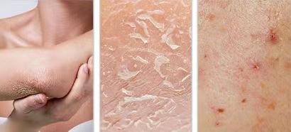 春天皮肤干燥而且易起皮，李佳琦推荐的这款沐浴露，补水滋润提亮